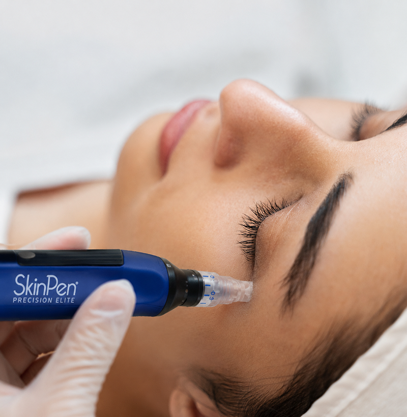 Medizinisches Microneedling in München