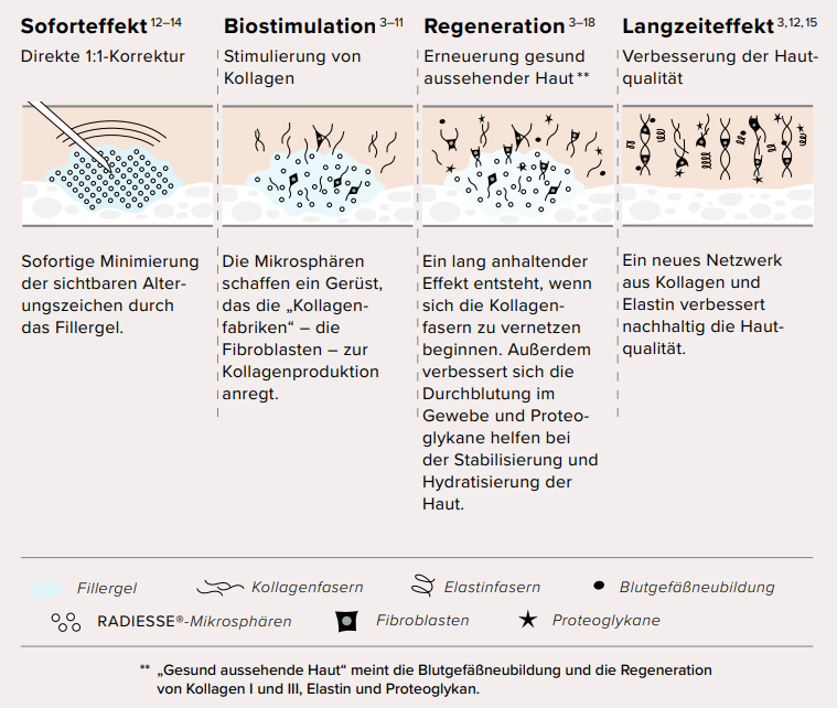 Radiesse Mikrosphären
